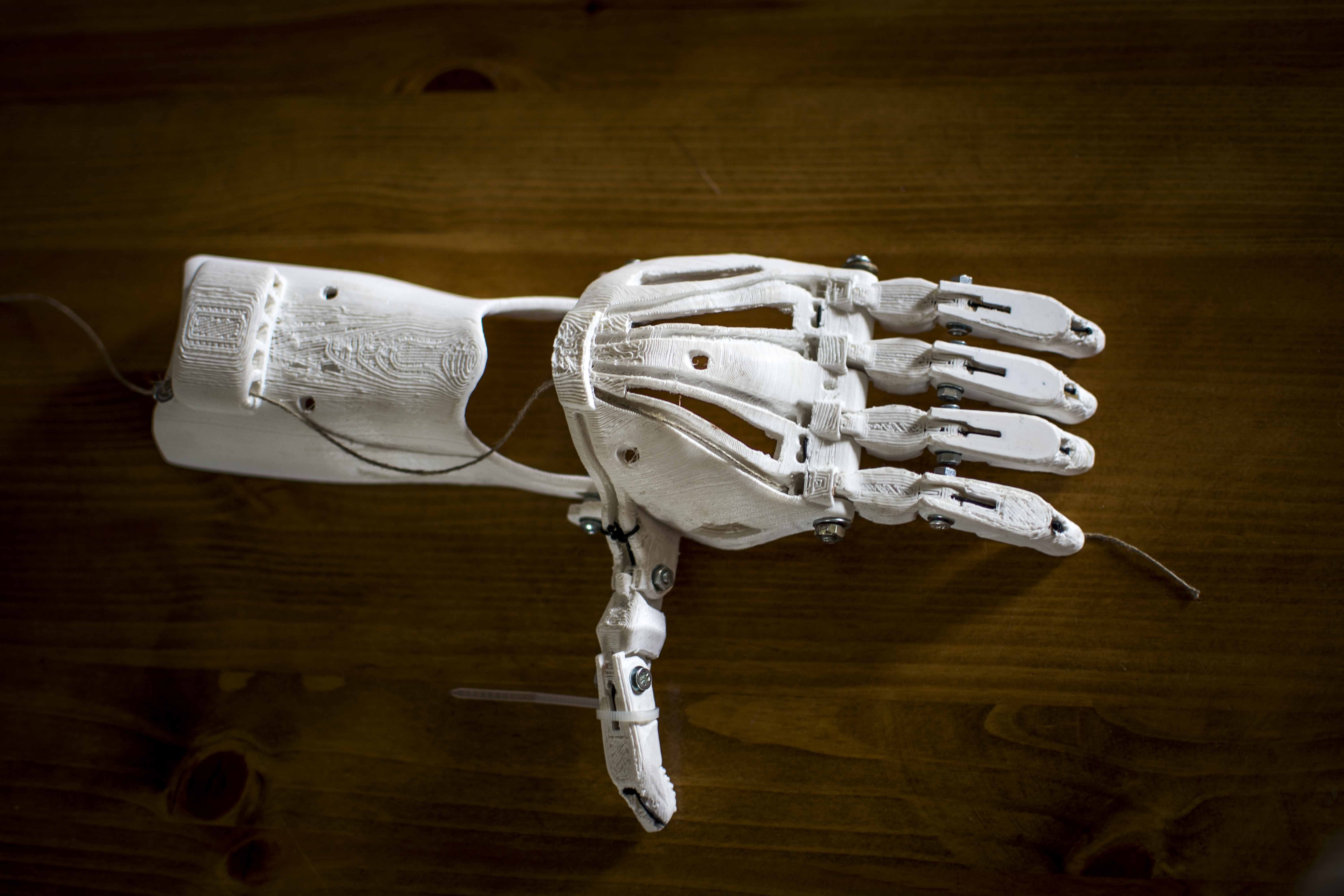 3D printed bionical hand